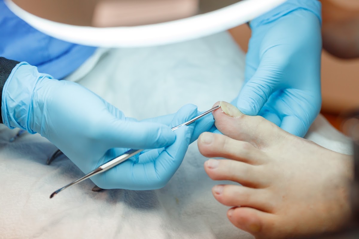 Medicinski pedikir Foot Medica - Usluge u Novom Sadu