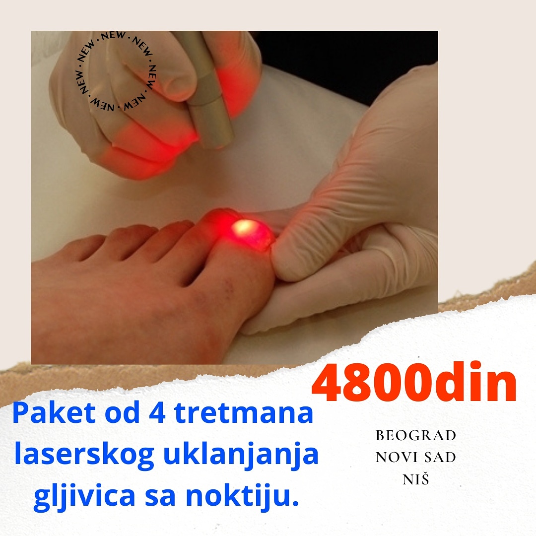 Laser centar Triniti Novi Sad - Usluge u Novom Sadu